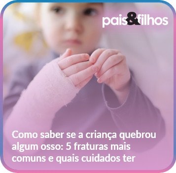 como-saber-se-a-crianca-quebrou-um-osso